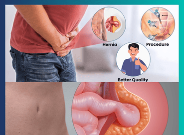 Hiatal Hernia in Young Adults: Causes, Symptoms, Treatment & Prevention