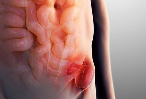 Hernia After C-Section: Causes, Symptoms & Treatment Options