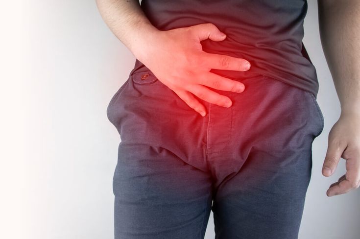 Inguinal Hernia: Causes, Symptoms, Diagnosis & Treatment