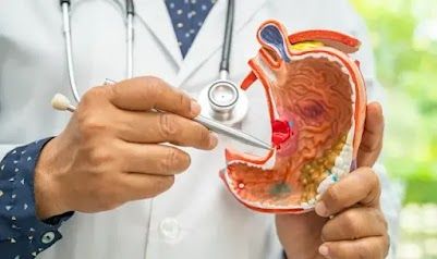 Gastric Sleeve Surgery for Sustained Weight Loss: Benefits & Procedure