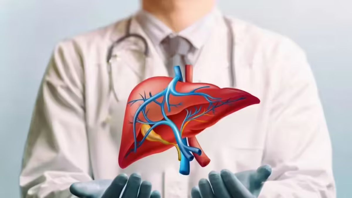 NAFLD / MASLD: Causes, Symptoms & Treatment