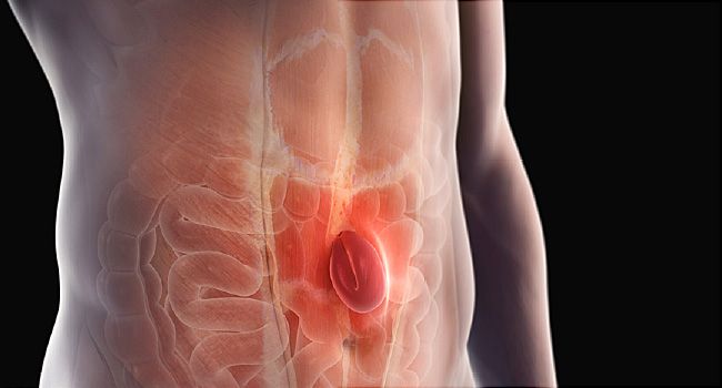 Hiatal Hernia – Symptoms, Diagnosis and Treatment