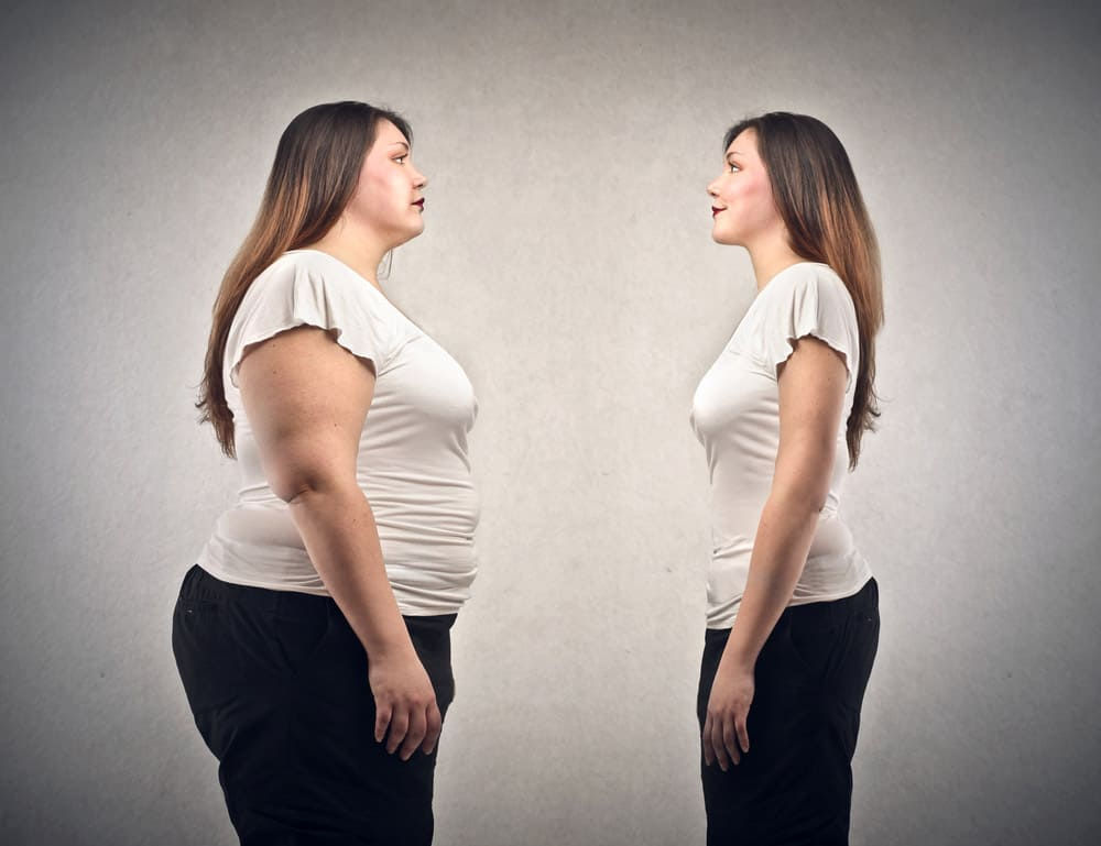Weight Loss Surgery and Its Advantages: Complete Guide