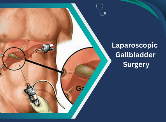 Advanced Gallbladder Surgery