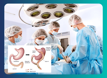 bariatric-surgery